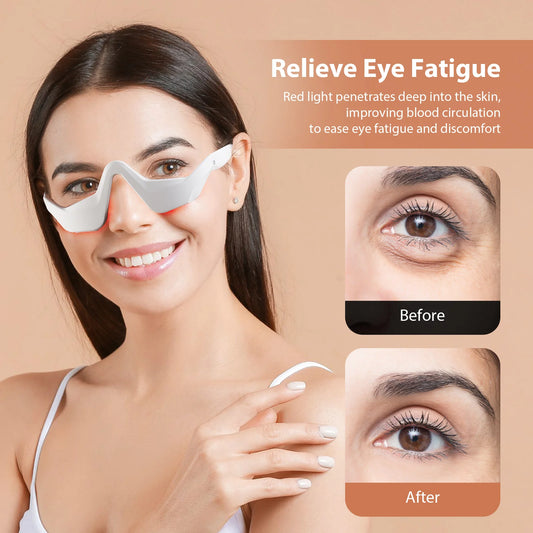 EMS Redlight Eye Massage Eyes Beauty Device Removal Dark Circles Anti-eye Wrinkles Fatigue Relief