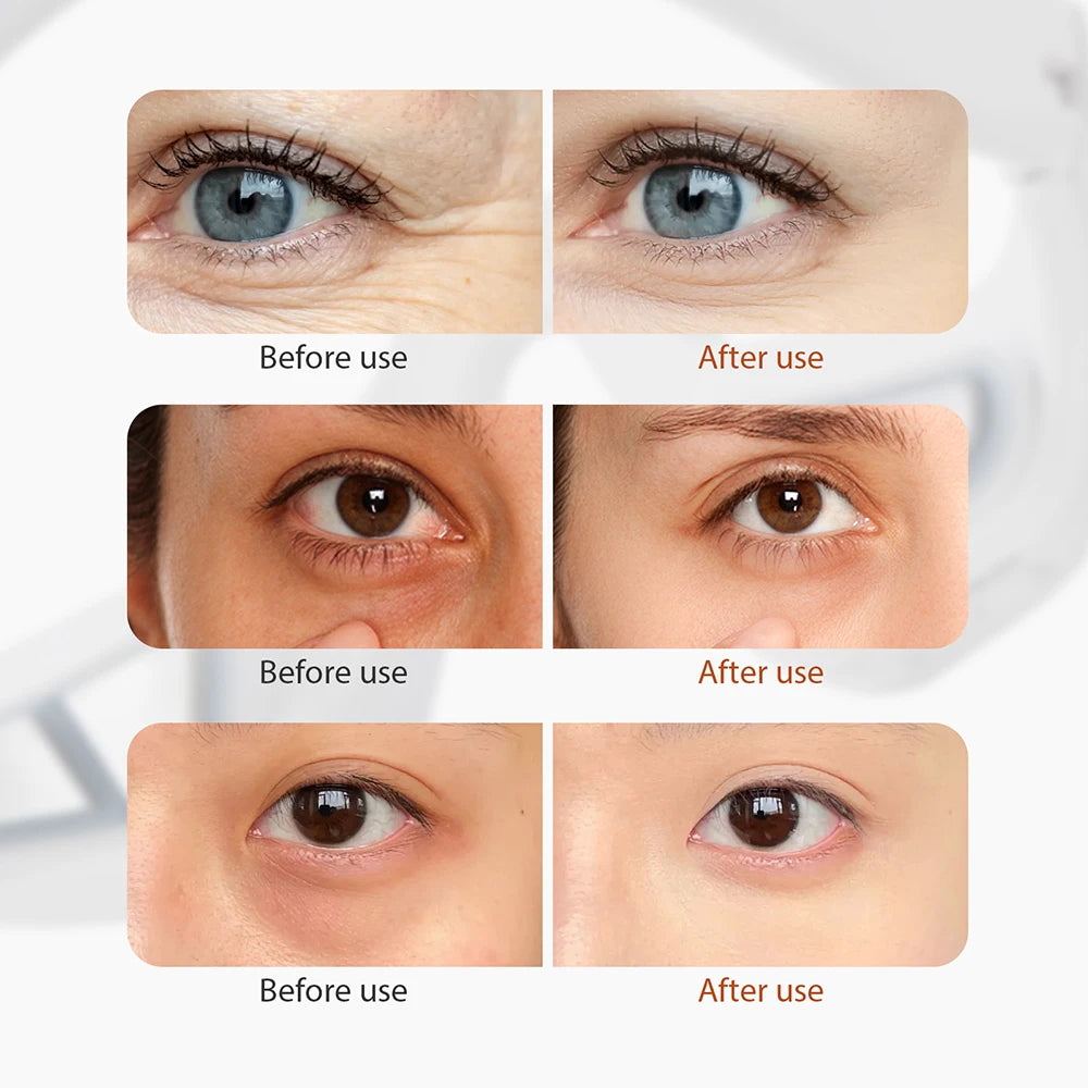 EMS Redlight Eye Massage Eyes Beauty Device Removal Dark Circles Anti-eye Wrinkles Fatigue Relief